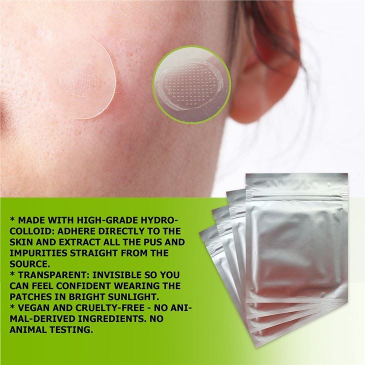 microneedle acne patch
