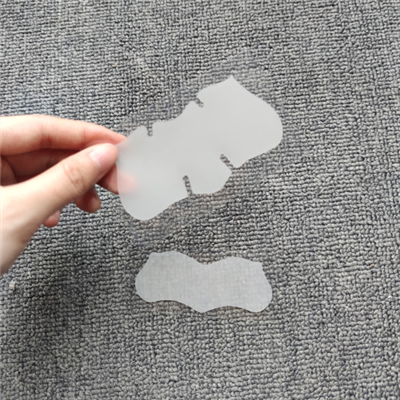 Nenänauhat Mustapäiden poisto